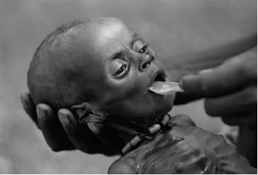 A desnutrição é uma das principais causas da mortalidade infantil